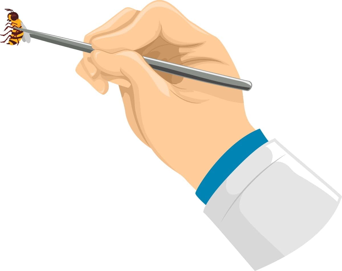 An illustration of bee venom therapy being applied to a hand