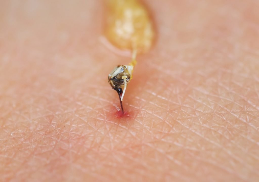 honey bee, why honey bees sting